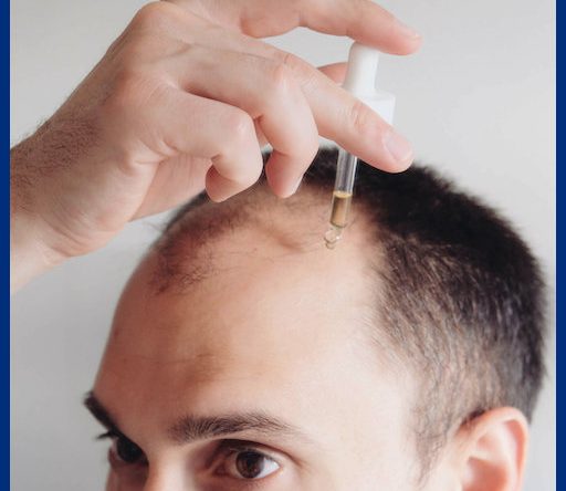 MinoZEN Minoxidil Topical Solution